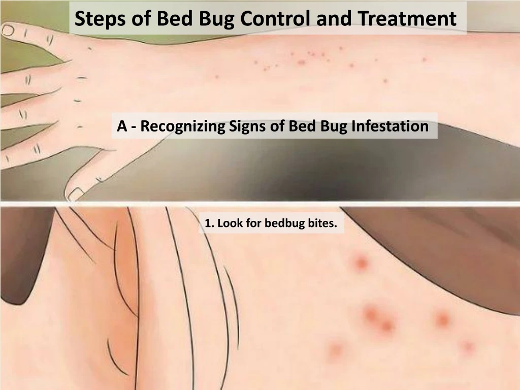 steps of bed bug control and treatment