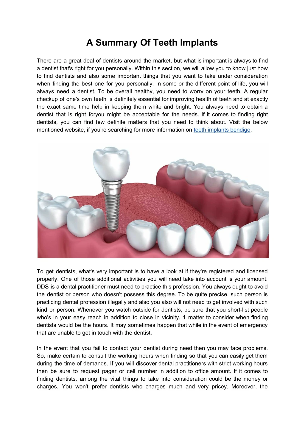 a summary of teeth implants