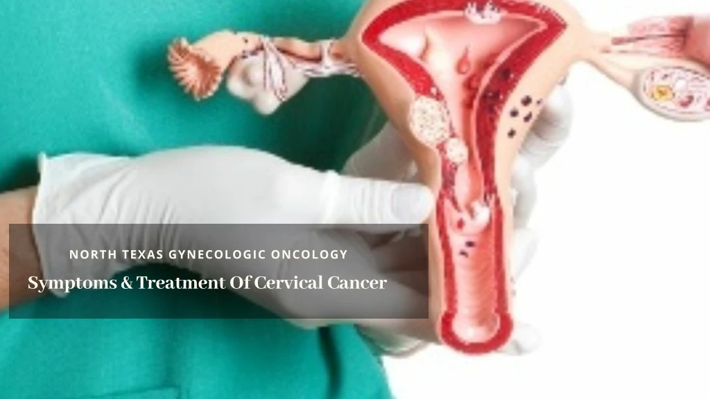 north texas gynecologic oncology symptoms