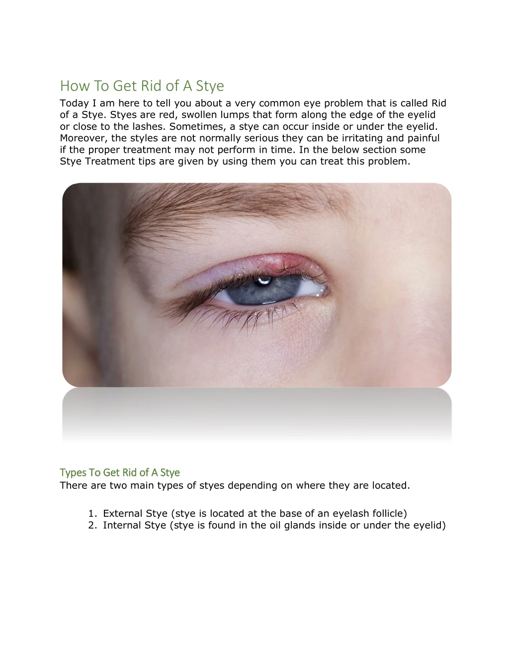 how to get rid of a stye today i am here to tell