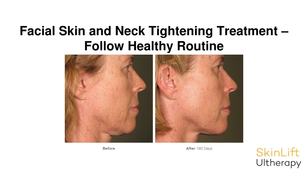 facial skin and neck tightening treatment follow healthy routine
