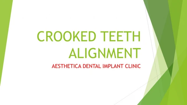 Crooked teeth alingment
