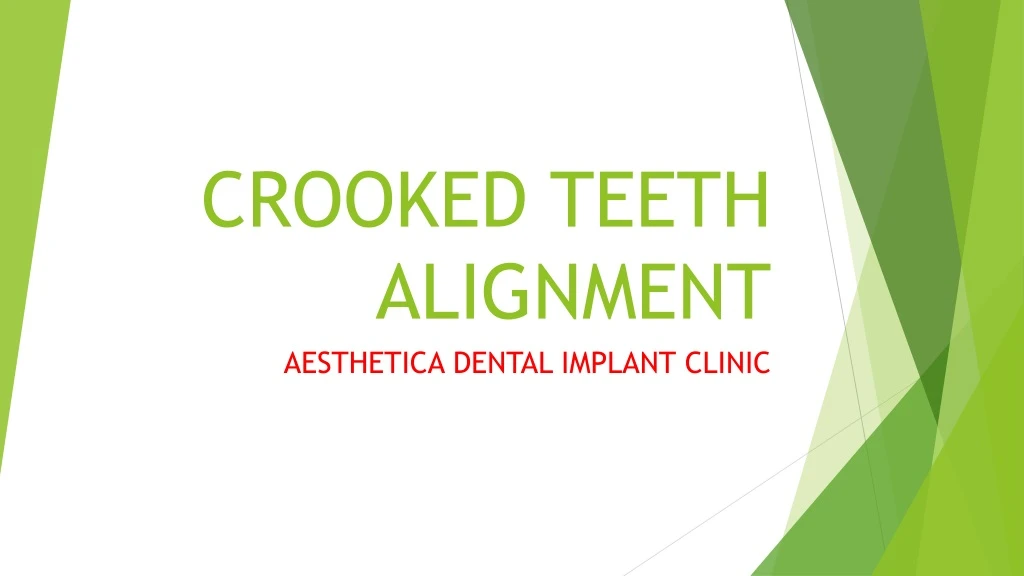 crooked teeth alignment