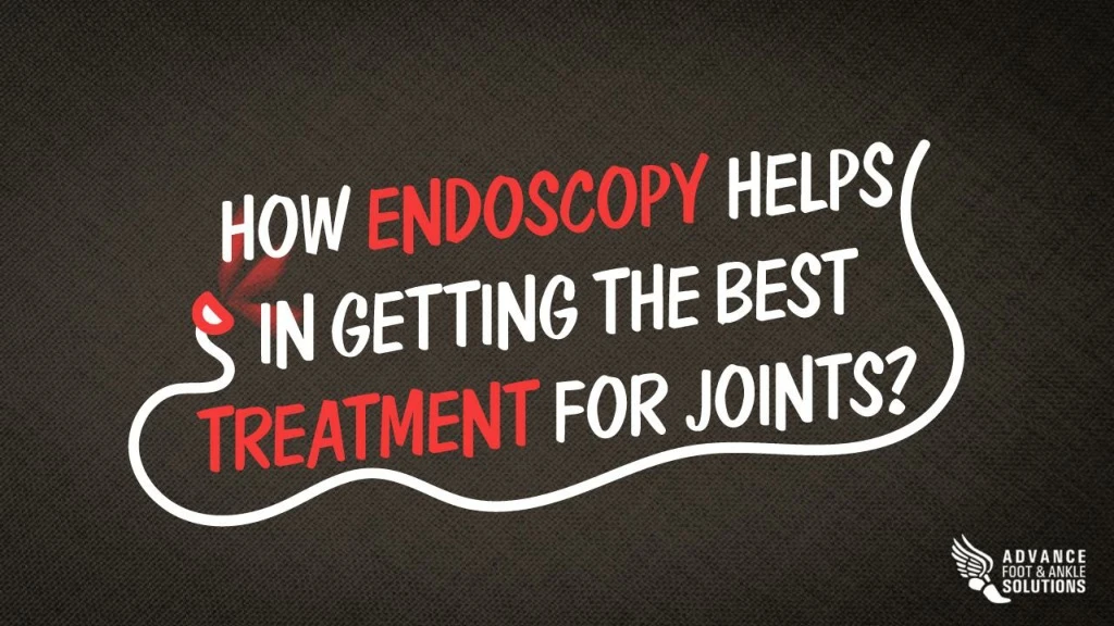 how endoscopy helps in getting the best treatment for joints