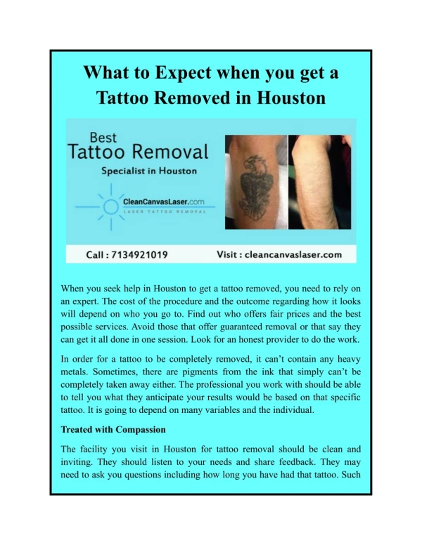 What to Expect when you get a Tattoo Removed in Houston