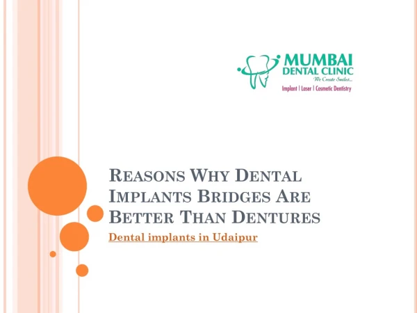 Reasons Why Dental Implants Bridges Are Better Than Dentures