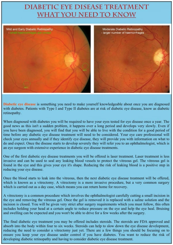 Diabetic Eye Disease Treatment What You Need to Know