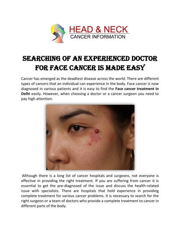 Searching of an experienced doctor for face cancer is made easy
