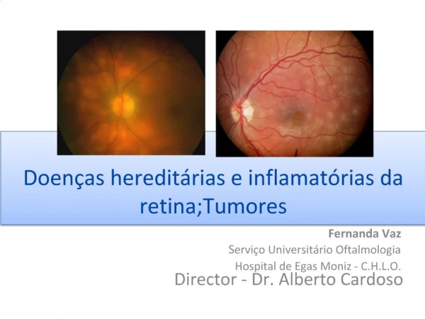 Doen as heredit rias e inflamat rias da retina;Tumores