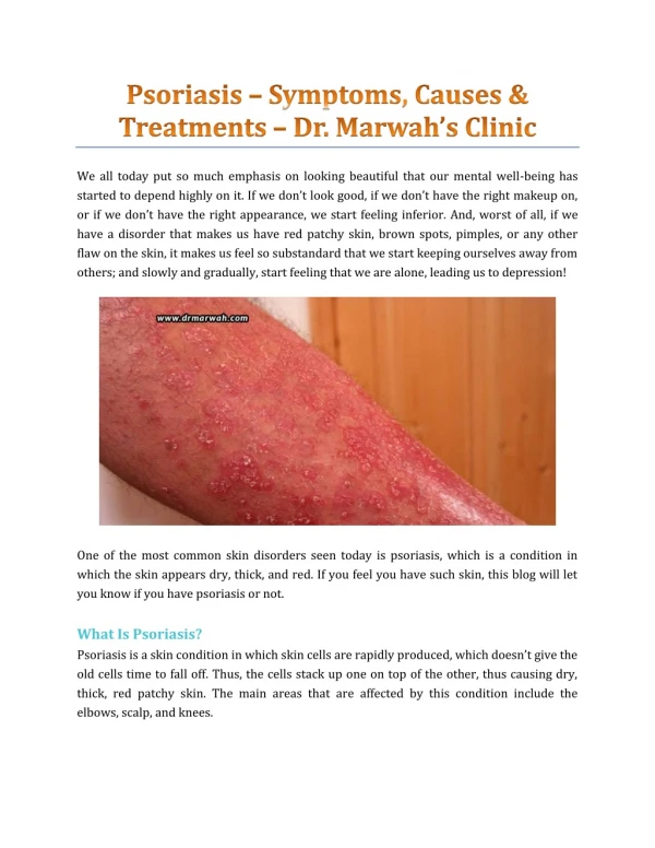 Psoriasis — Symptoms, Causes & Treatments — Dr. Marwah’s Clinic