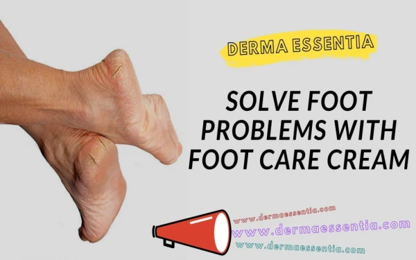 Solve Foot Problems with Foot Care Cream