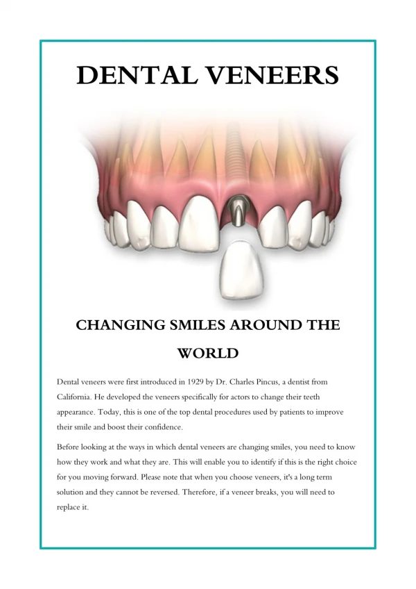 Dental Veneers Changing Smiles Around The World