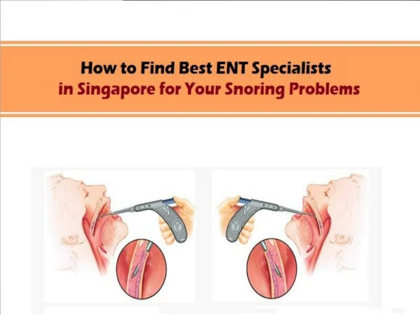 How to Find Best ENT Specialists in Singapore for Your Snoring Problems