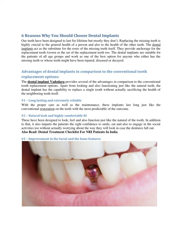 6 Reasons Why You Should Choose Dental Implants