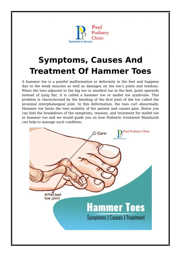 Symptoms, Causes And Treatment Of Hammer Toes