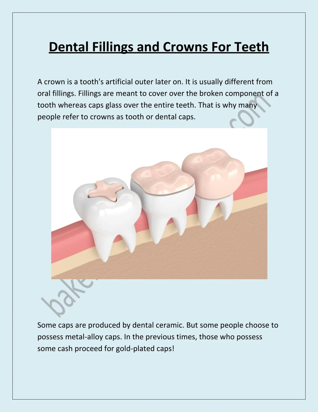 dental fillings and crowns for teeth