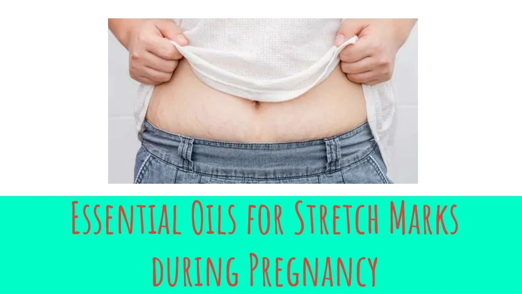 essential oils for stretch marks during pregnancy