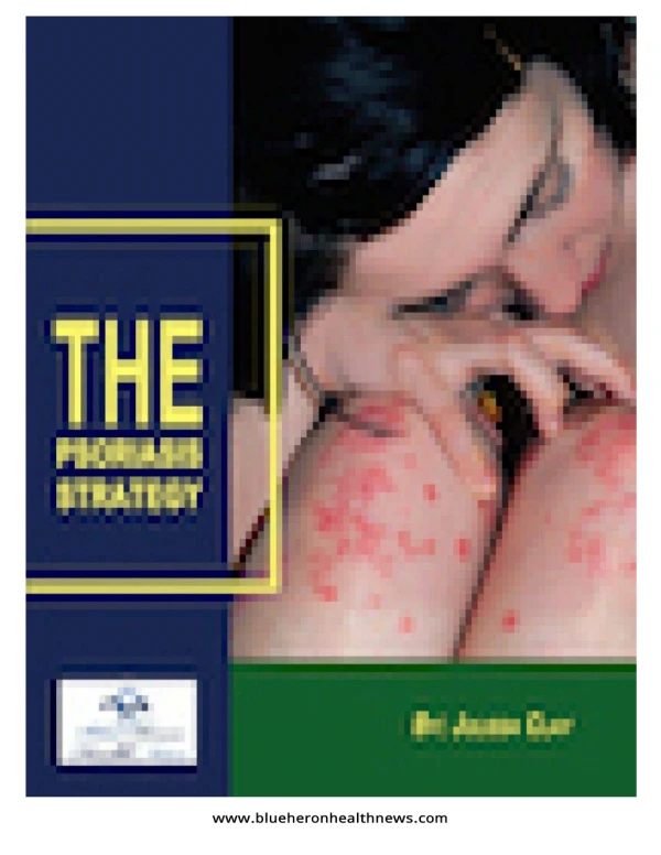 (PDF) The Psoriasis Strategy PDF Free Download: Julissa Clay