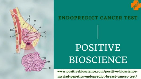 EndoPredict Cancer Test | Best Treatment Help | Most Accurate Results 