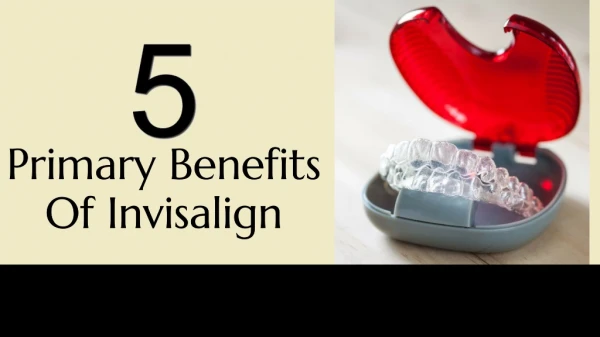 5 Primary Benefits Of Invisalign