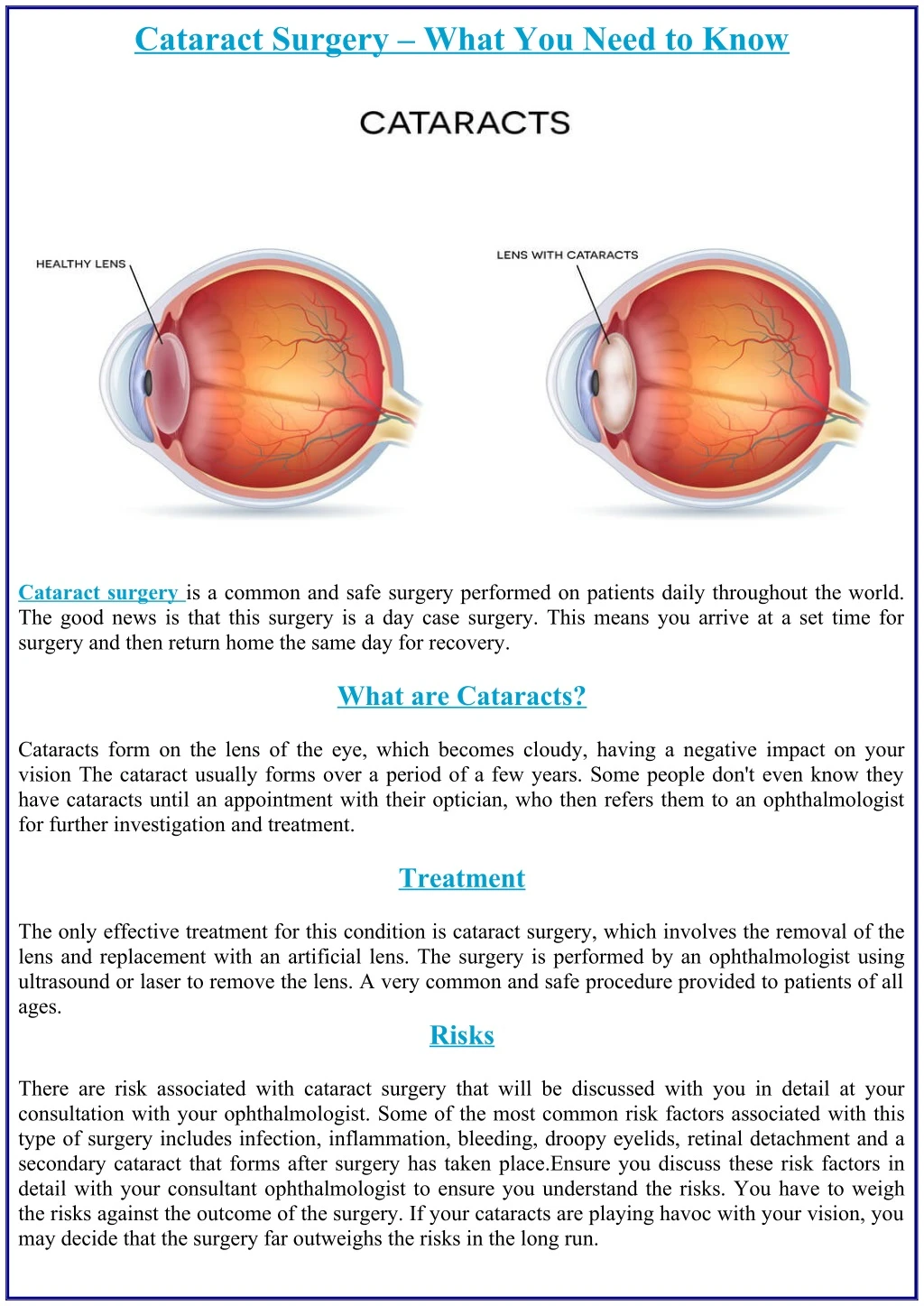 cataract surgery what you need to know