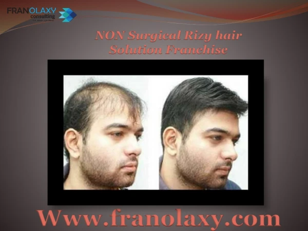 non surgical transplant Rizy hair solution salon franchise business opportunities in whole India
