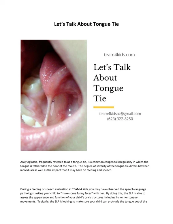 Let’s Talk About Tongue Tie | Speech Therapist In Peoria AZ