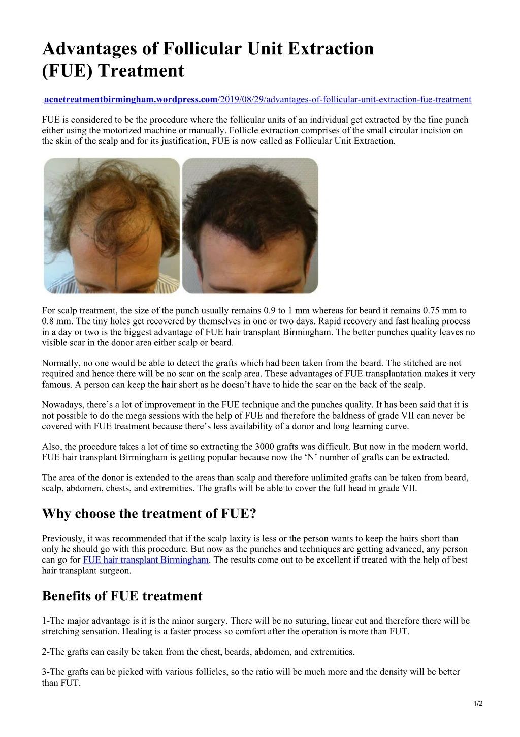 advantages of follicular unit extraction