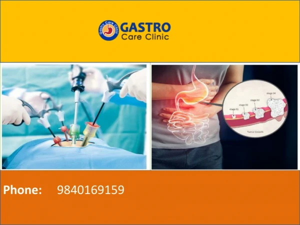 Gastroenterologist In Chennai