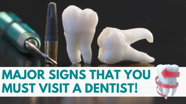 Major Signs That You Must Visit A Dentist!