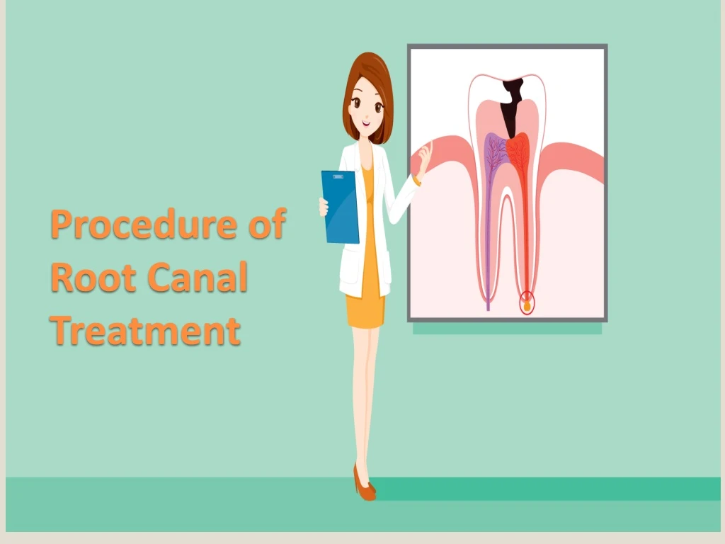 procedure of root canal treatment