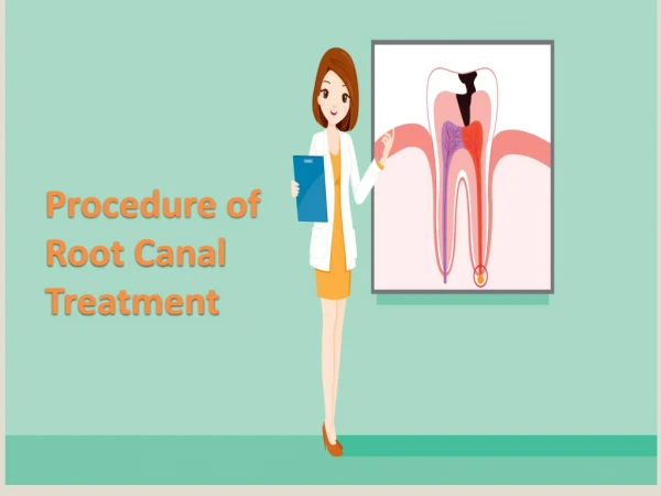 Root Canal Treatment Prcess