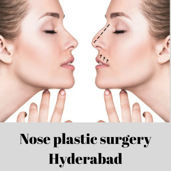 nose reshaping cost in hyderabad