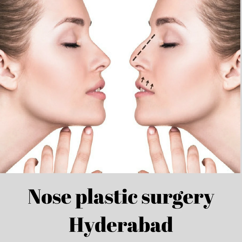 nose plastic surgery hyderabad
