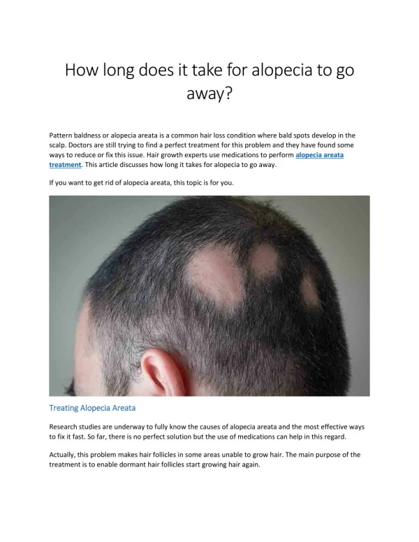 How long does it take for alopecia to go away?