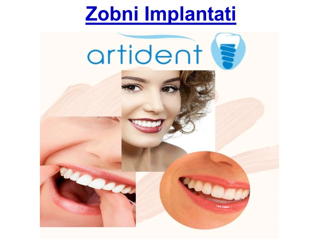 zobni implantati