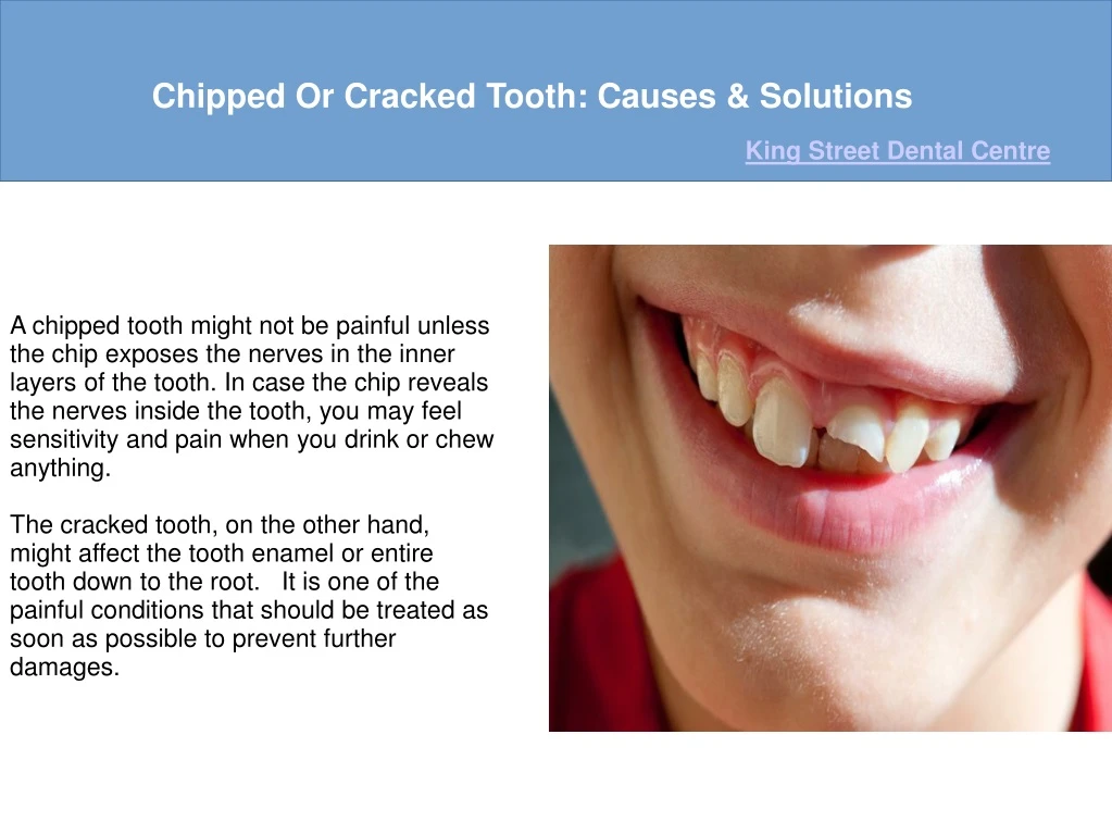 chipped or cracked tooth causes solutions
