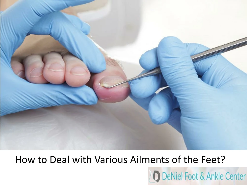 how to deal with various ailments of the feet