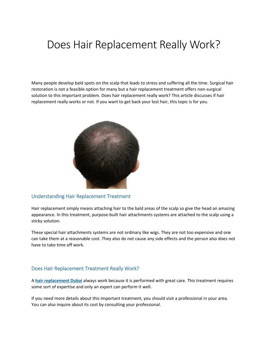 does hair replacement really work