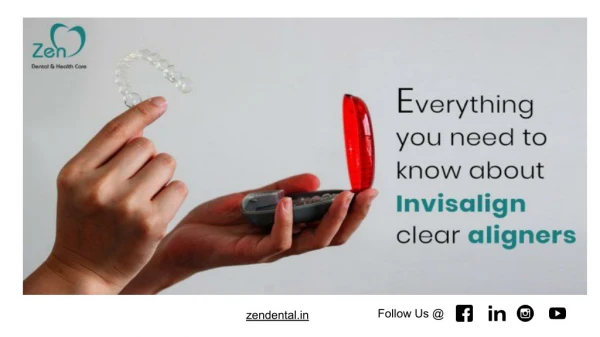Everything you need to know about invisalign clear aligners