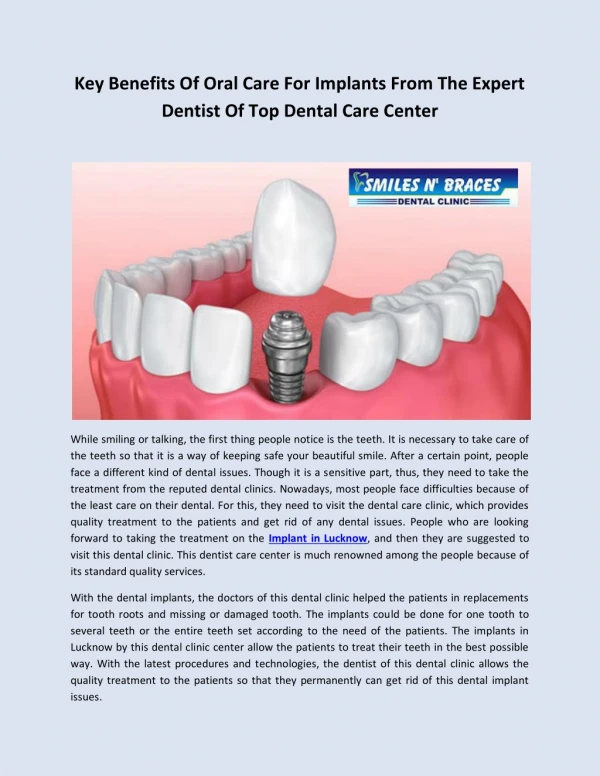 Key Benefits Of Oral Care For Implants From The Expert Dentist Of Top Dental Care Center