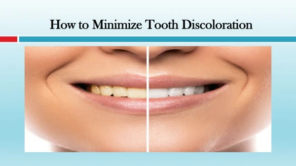 How to Minimize Tooth Discoloration