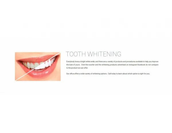 Tooth Whitening in Marine City