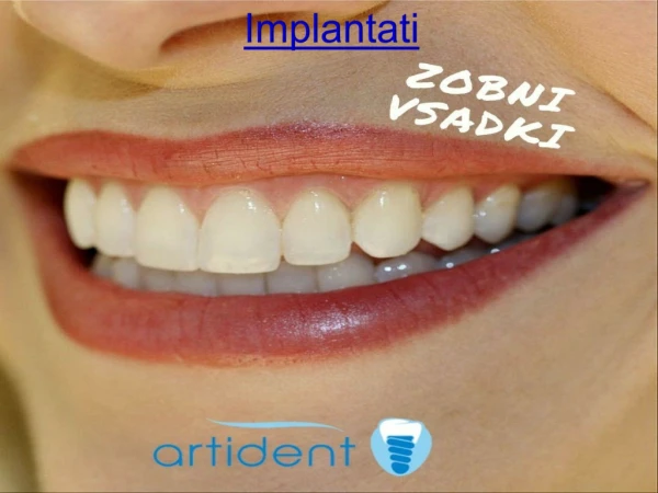 implantati