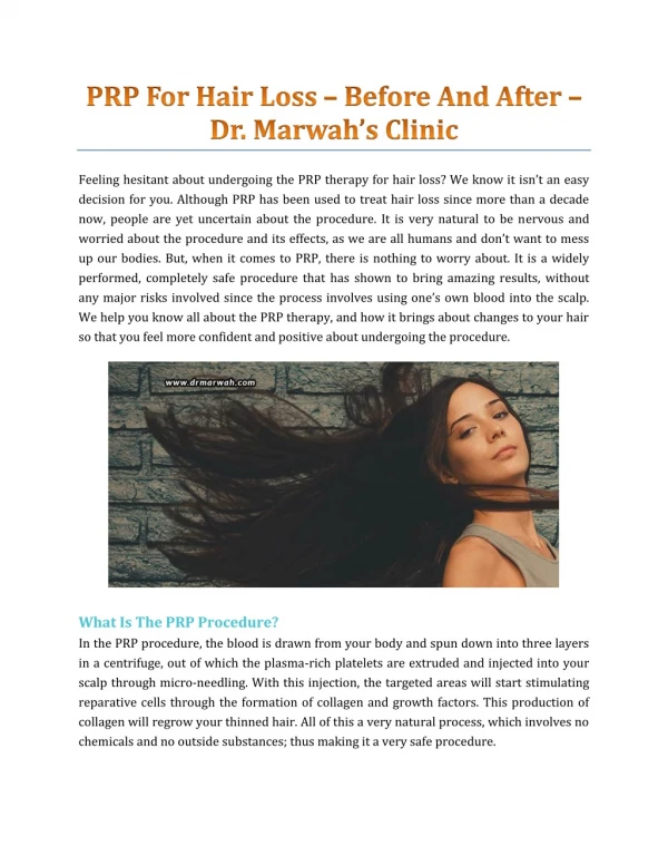 PRP For Hair Loss – Before And After - Dr. Marwah's Clinic