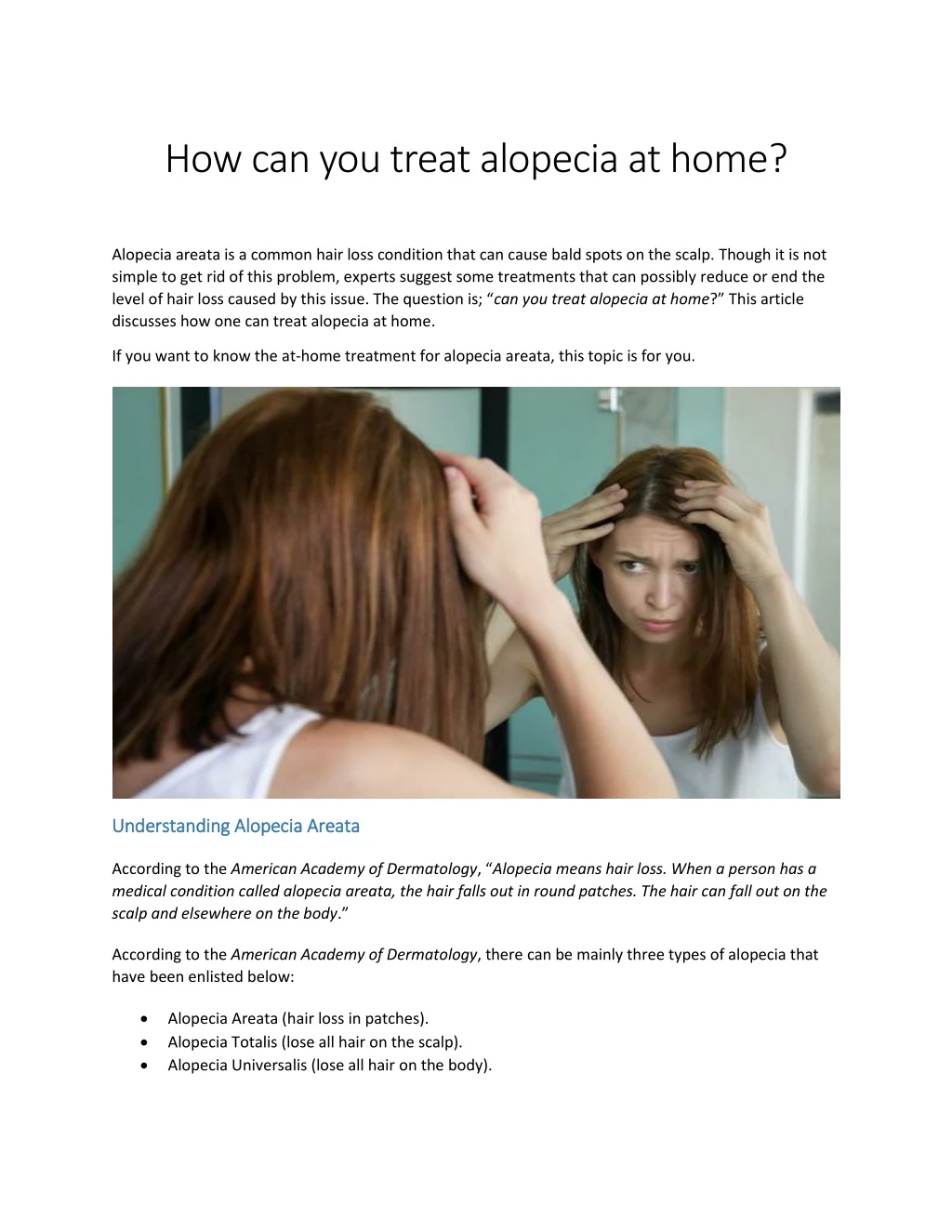 how can you treat alopecia at home