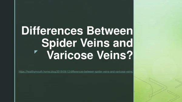 Differences Between Spider Veins and Varicose Veins?