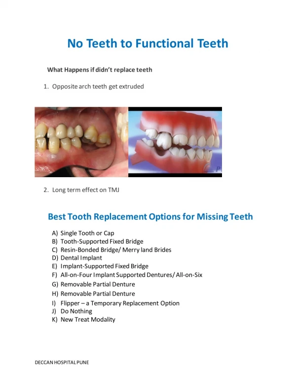 DENTAL IMPLANT - PERMANENT TEETH REPLACEMENT TYPES, ADVANTAGE , DISADVANTAGE - BY DECCAN HOSPITAL