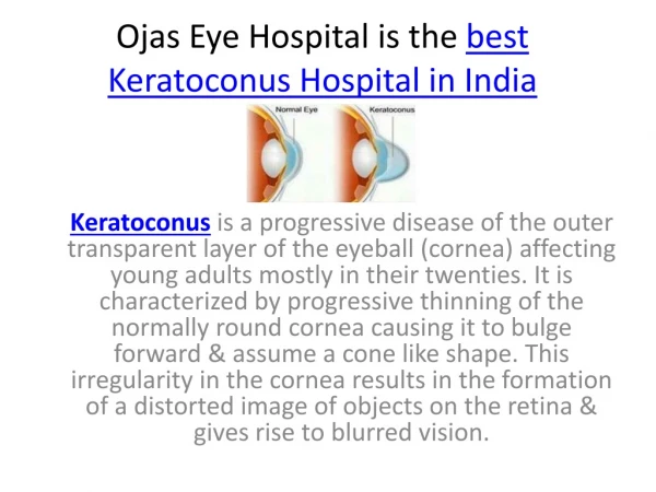 Ojas eye hospital is the best keratoconus hospital in India