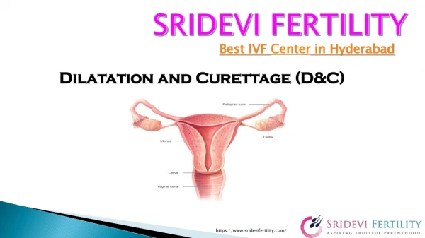 D&C Cost in Hyderabad | Best Fertility Specialist in Hyderabad